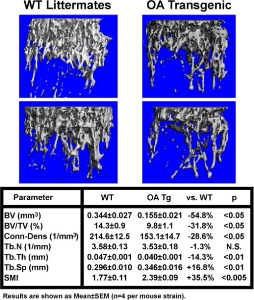 Comparison Of M Ct Bone Parameters At The Secondary Spo Open I