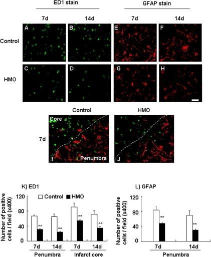 ED1 and GFAP positive cells in the penumbra.Immunohisto | Open-i