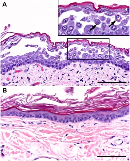 Histopathology Findings For Neonatal Puppies With Ectod 