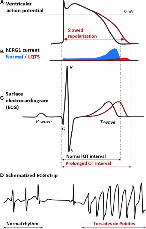 diagram class qt potentials signals ECG related Ventricular and action