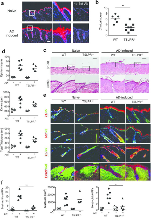 The Th2-promoting cytokine TSLP contributes to skin inf | Open-i