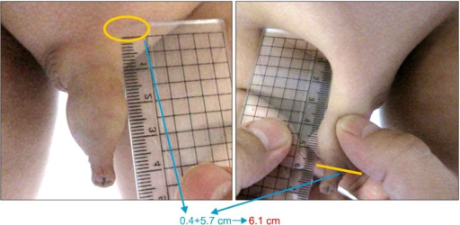 Measurement Of Penis 68