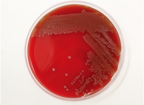 Gray-whitish, α-hemolytic colonies of Streptococcus su | Open-i