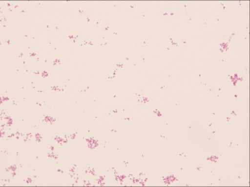 Gram Stain Of Neisseria Sicca Open I