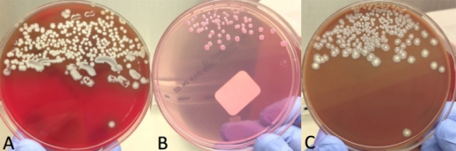 Burkholderia Pseudomallei Colonies Growing On (A) Sheep | Open-i