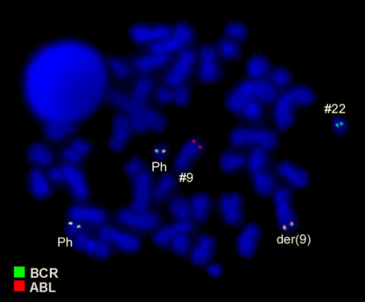 Fluorescence In Situ Hybridization (FISH) Using Probes | Open-i