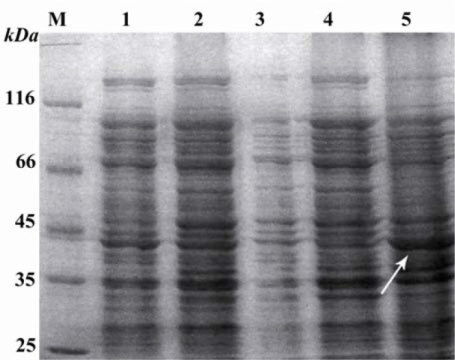thesis on molecular markers A molecular weight marker such as a known protein or standard that produces bands of known size, migrates to the resolving gel, and is. thesis on molecular markers A molecular weight marker such as a known protein or standard that produces bands of known size, migrates to the resolving gel, and is.