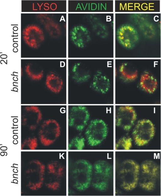 lysosome glycogen Pan P H, P, Callaerts B, KK, Dermaut Norga Verstreken Y, Kania A, Zhou