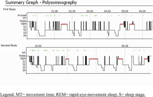 ideopathic hupersomnia hypnogram