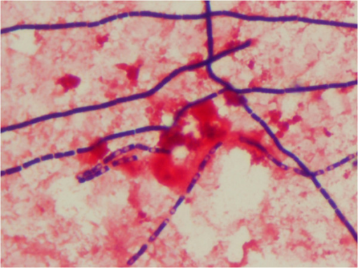 gram-stain-of-b-anthracis-showing-large-gram-positive-open-i