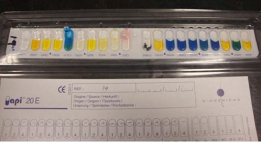 The Results Of Biochemical Tests For Acinetobacter Baum Open I