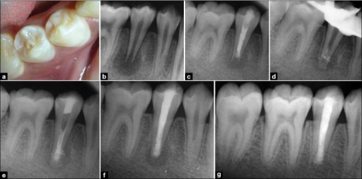 Matrix - Oral Access Matrix - Oral Access