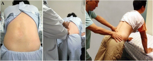 lumbar lumbar flexion-extension