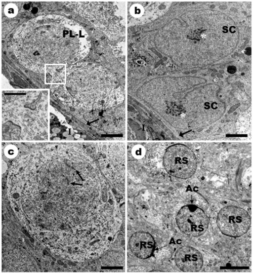 Ultrastructure of the germ cells in stage 1 of the semi | Open-i