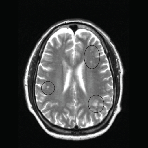 Mri Image Of The Brain In An Axial View Showing The “ Open I