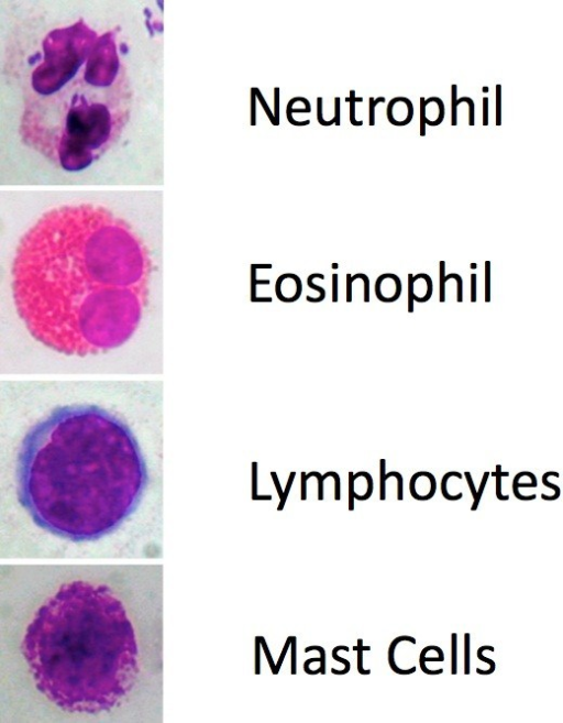 Immunoflogosis: Staining With May-Grunwald-Giemsa (MGG) | Open-i