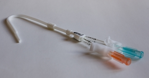 A permanent (tunnelled) haemodialysis catheter with sta | Open-i