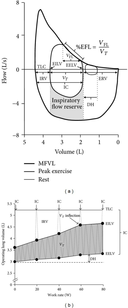 (a) Example of a resting and peak exercise tidal breath | Open-i