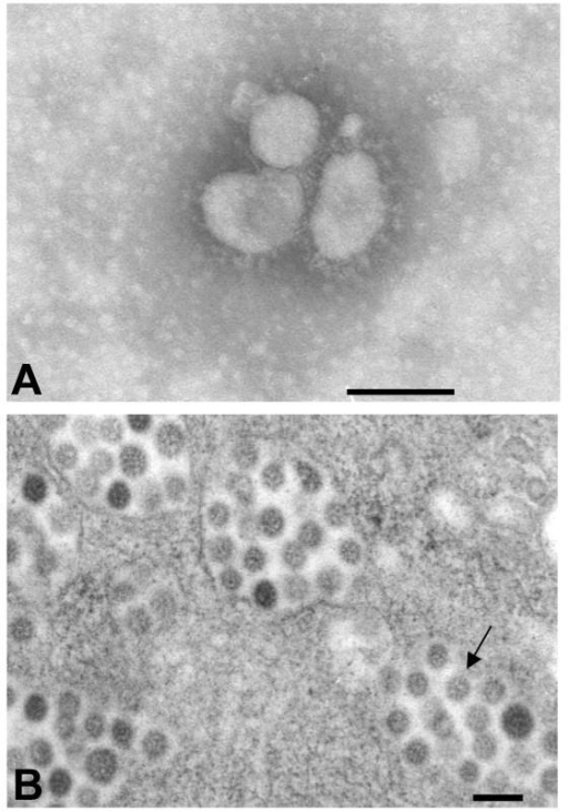 SARS-CoV transmission electron microscopy. In the supernatant of SARS-CoV infected cytopathic Vero E6 cells, characteristic virus particles can be found. The diameter of the viruses ranges between 60 nm and 120 nm and the virus shapes are round or oval. There are many protrusions from the envelope which are arranged in order with wide gaps between them. There are also many virus particles in the infected cells present. They often form a virus vesicle with an encircling membrane. A: Higher magnification B: Lower magnification. Scale bars represent 100 nm. Reproduced with permission from Acta Biochimica et Biophysica Sinica 2003, 35(6):587–591 [126].