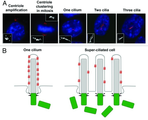 Differentialdiagnose pocket