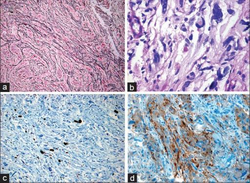 Histopathological staining. (a) Reticulin stain; (b) PA | Open-i