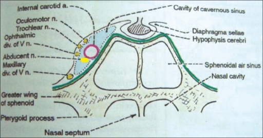 Coronal section through the cavernous sinus to show its | Open-i