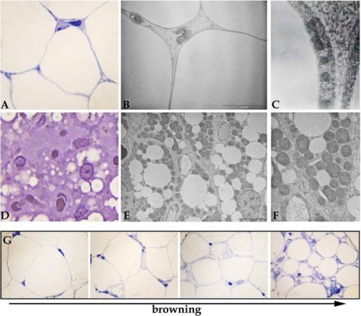 The Structure Of White Adipocyte (A–C) And Brown Adip | Open-i