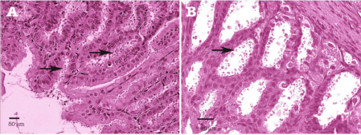 Experimental Cryptosporidium muris infection of SCID mi | Open-i