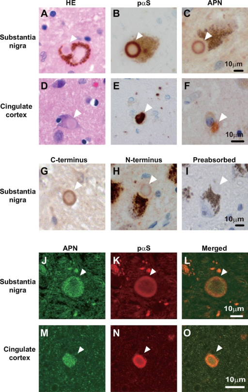 Immunostaining Of Apn In Human Brains In Cases Of A Syn Open I