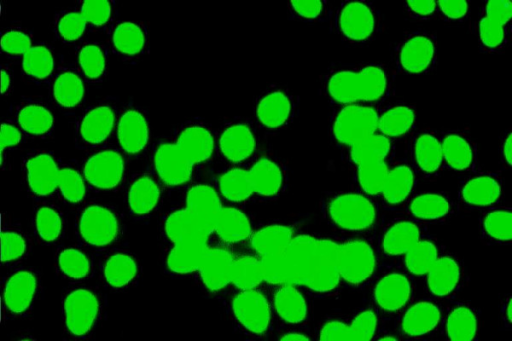 high-titer-antinuclear-antibodies-ana-of-the-homogene-open-i