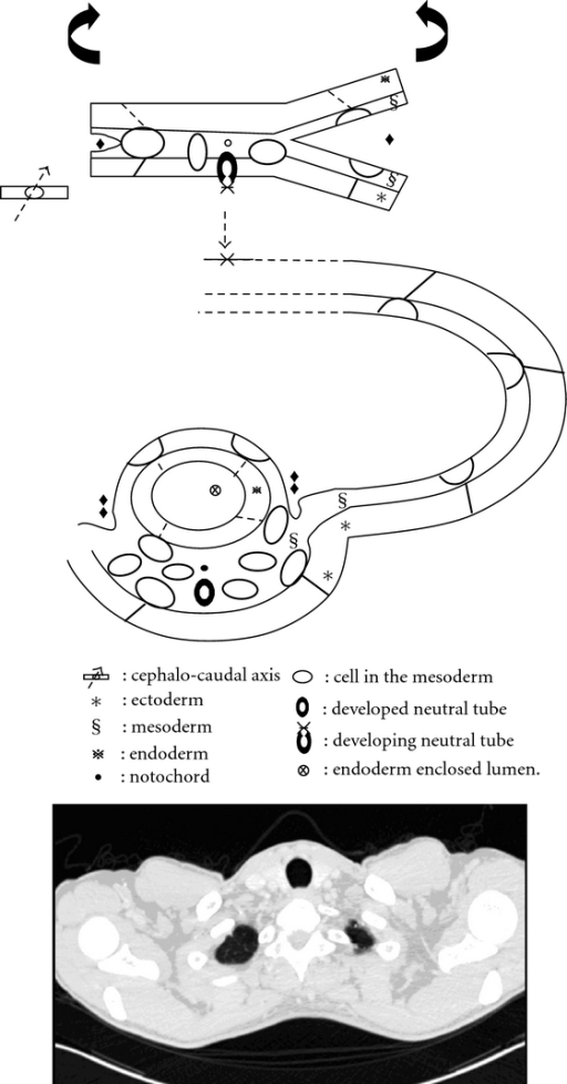 Body Cavity Formation Diagram Shows The Mesoderm Split