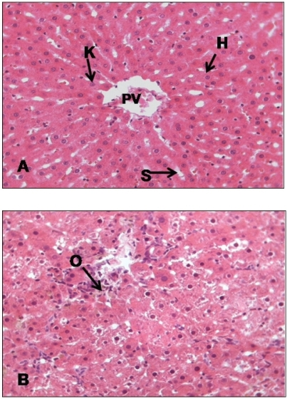 H & E staining on liver tissue of (A) control group | Open-i