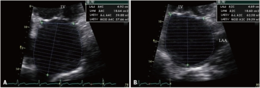 biplane-left-atrial-la-volume-measurement-in-apical-4-open-i