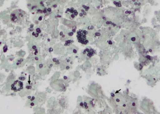 Photomicrograph Of Penicillium Marneffei (courtesy Of K 