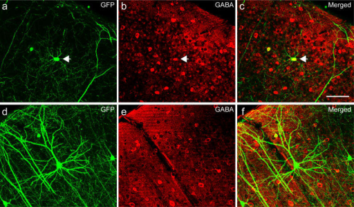 pyramidal neurons cortex