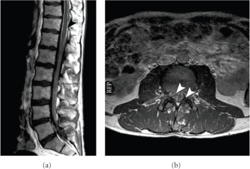 (a) Sagittal and (b) transversal T1-weighted contrast-e | Open-i