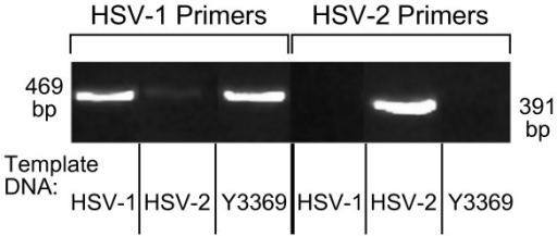 Isolate Y3369 Is An Hsv 1 Strain Not An Hsv 2 Virus By Open I