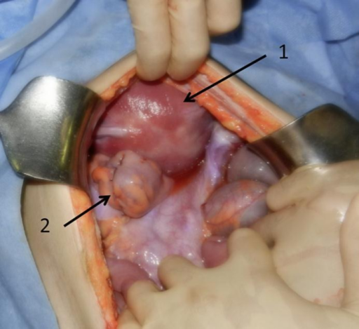 actual fetus size by week