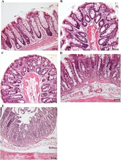 Histopathological characterization of DSS-induced colit | Open-i