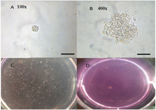 Representatives of colony in soft agar.(A) A colony in | Open-i