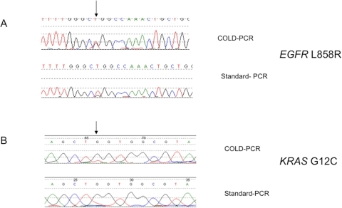 Science Fiction Essay Topics Examples Of Comparative Analysis Of Coldpcr Vs Standardpcrsequencing Electrogramme Of Essay On Health Awareness also Essay Examples High School Examples Of Comparative Analysis Of Coldpcr Vs Standar Openi Sample Essay English
