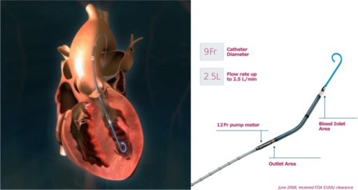 Impella Catheter