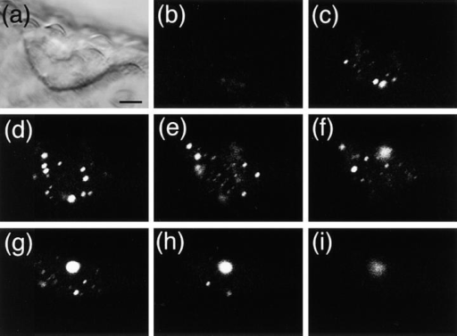 Confocal optical sectioning of the trichome nucleus in | Open-i