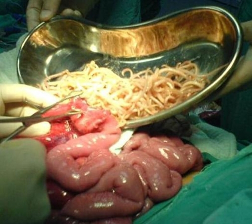 Image result for Tropical Diseases