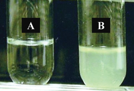 a-photograph-of-the-white-turbid-urine-excreted-after-1-open-i