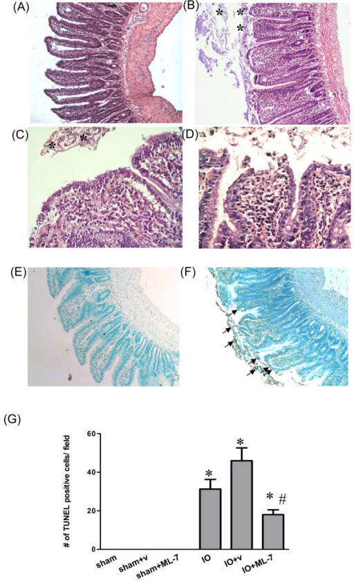 Histological images of the distal small intestine of sh | Open-i