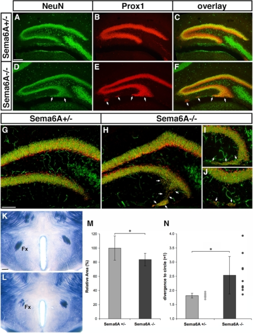 Alterations in hippocampal lamination and projections.( | Open-i