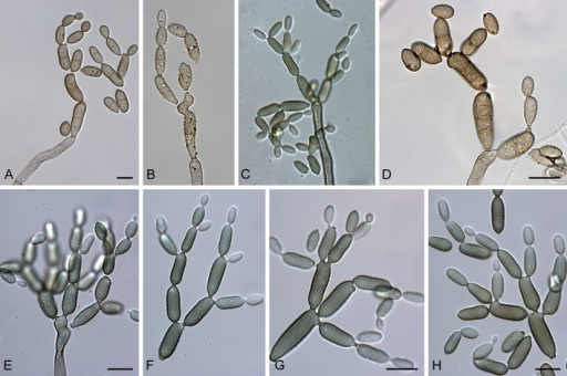 Cladosporium allii (CBS 101.81). A-H. Conidiophores and | Open-i