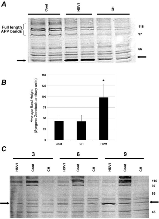 university of washington hsv western blot