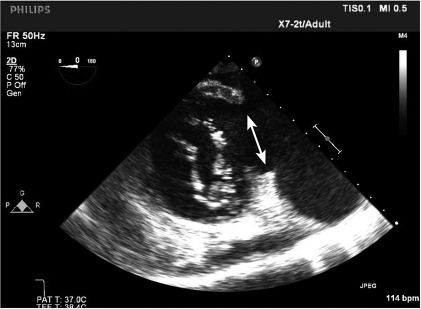 Transesophageal echocardiography. The transgastric basa | Open-i